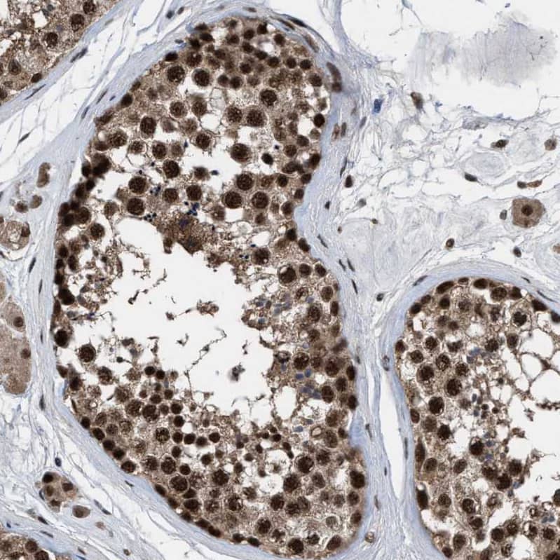 Immunohistochemistry-Paraffin PRPF4 Antibody - BSA Free
