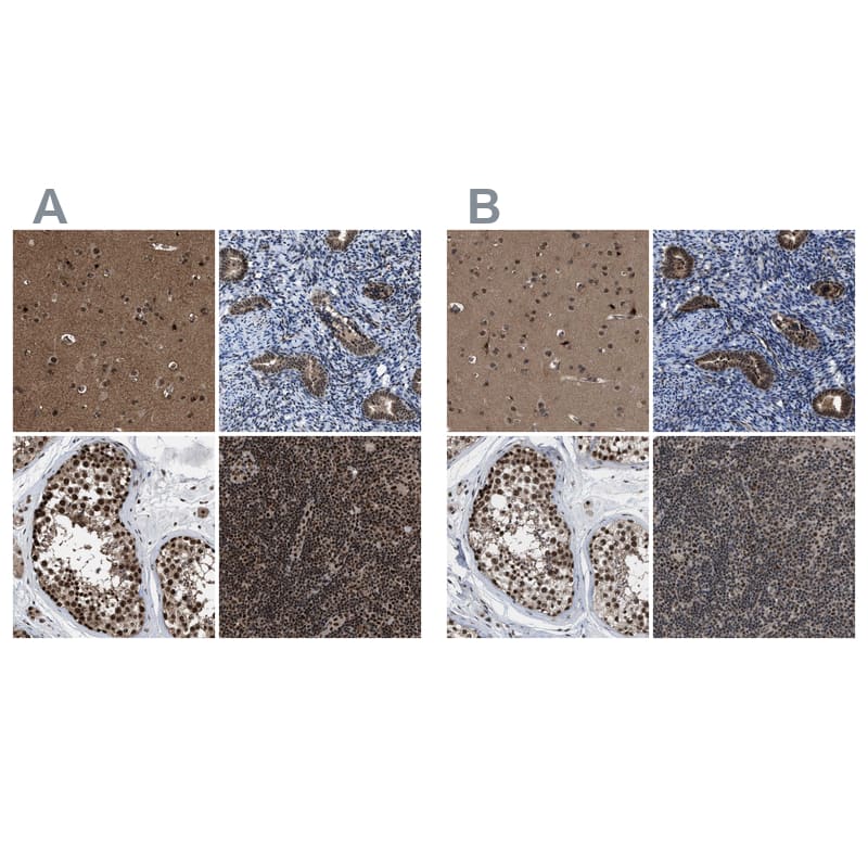 Immunohistochemistry-Paraffin PRPF4 Antibody - BSA Free