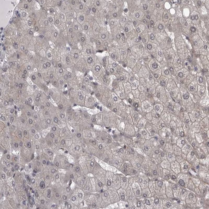 Staining of human liver shows no nuclear positivity in hepatocytes as expected.