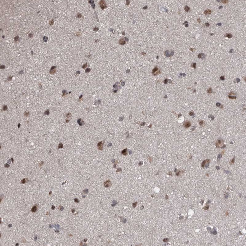 Staining of human cerebral cortex shows moderate nuclear positivity in neurons.