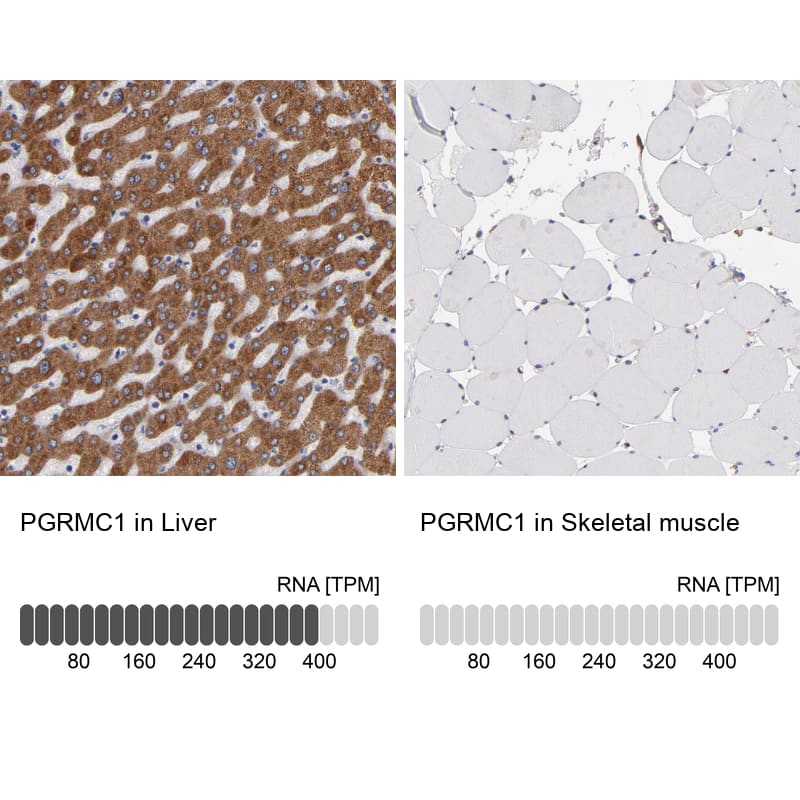 Analysis in human liver and skeletal muscle tissues using NBP1-83220 antibody. Corresponding PGRMC1 RNA-seq data are presented for the same tissues.