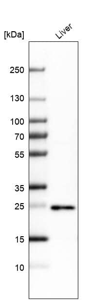Analysis in human liver tissue.