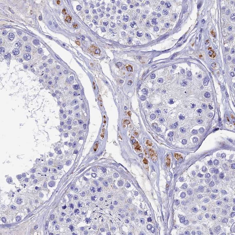 Immunohistochemistry-Paraffin OAT Antibody - BSA Free