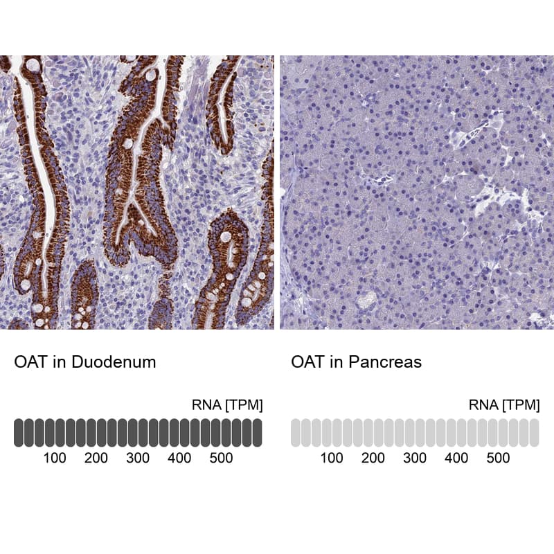 Immunohistochemistry-Paraffin OAT Antibody - BSA Free