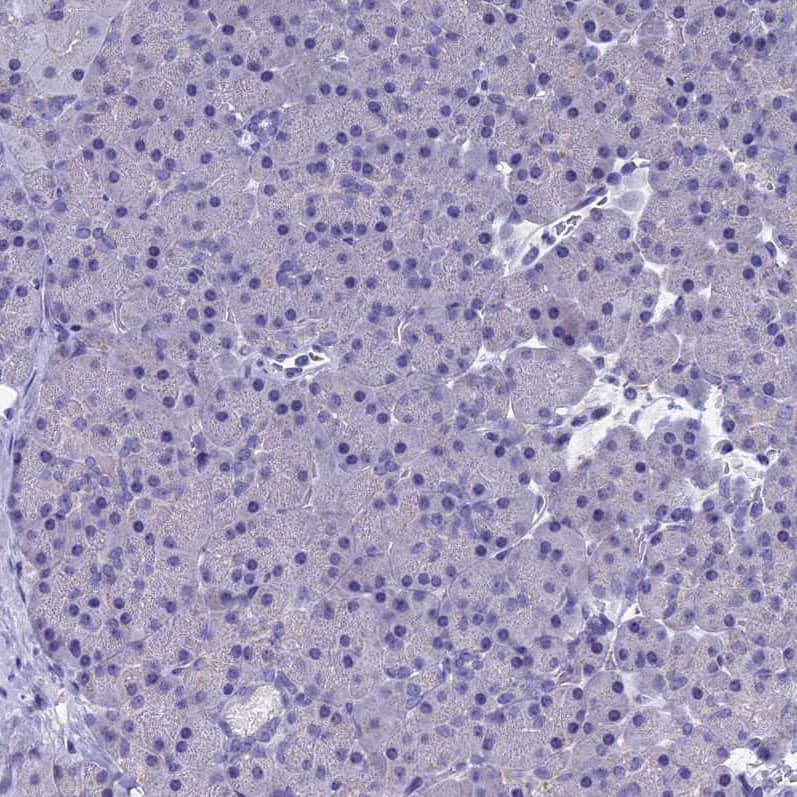 Staining of human pancreas shows no positivity in exocrine glandular cells as expected.