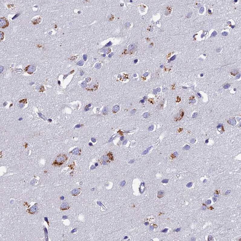 Staining of human cerebral cortex shows moderate to strong granular cytoplasmic positivity in neurons.