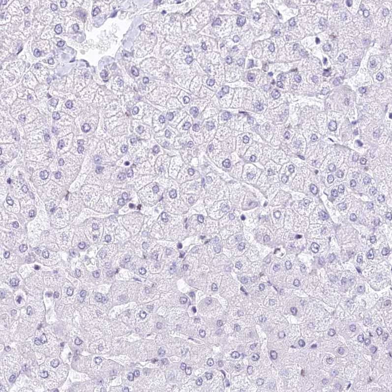Immunohistochemistry-Paraffin HNRNPA0 Antibody