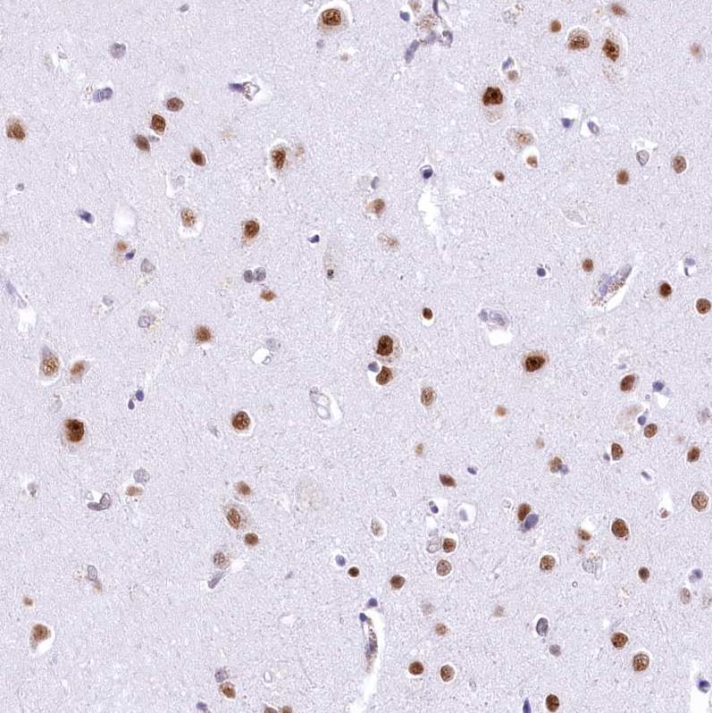 Immunohistochemistry-Paraffin HNRNPA0 Antibody