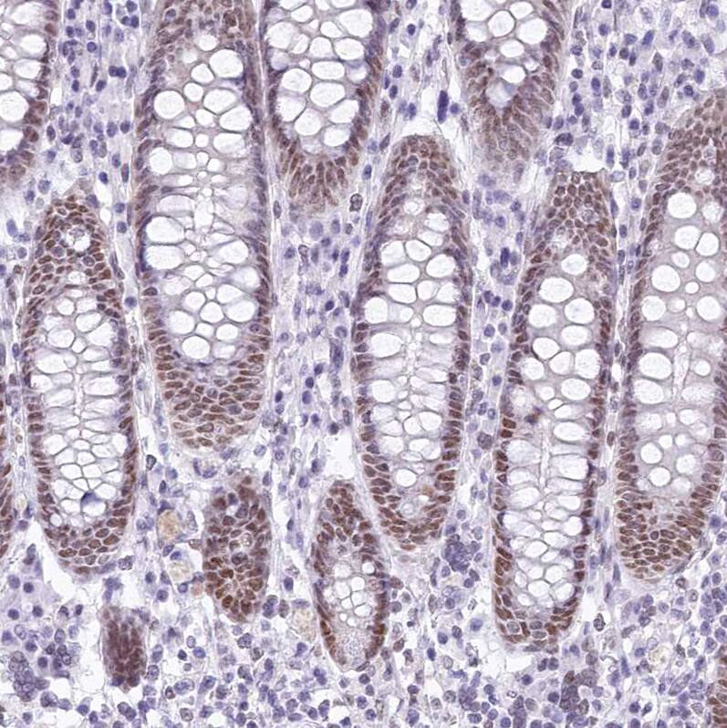 Immunohistochemistry-Paraffin HNRNPA0 Antibody