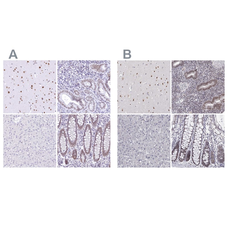Immunohistochemistry-Paraffin HNRNPA0 Antibody