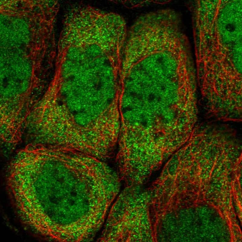 Staining of human cell line A-431 shows localization to nucleoplasm & cytosol.