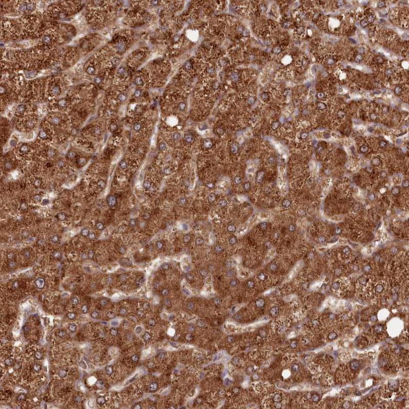Staining of human liver shows strong cytoplasmic positivity in hepatocytes.