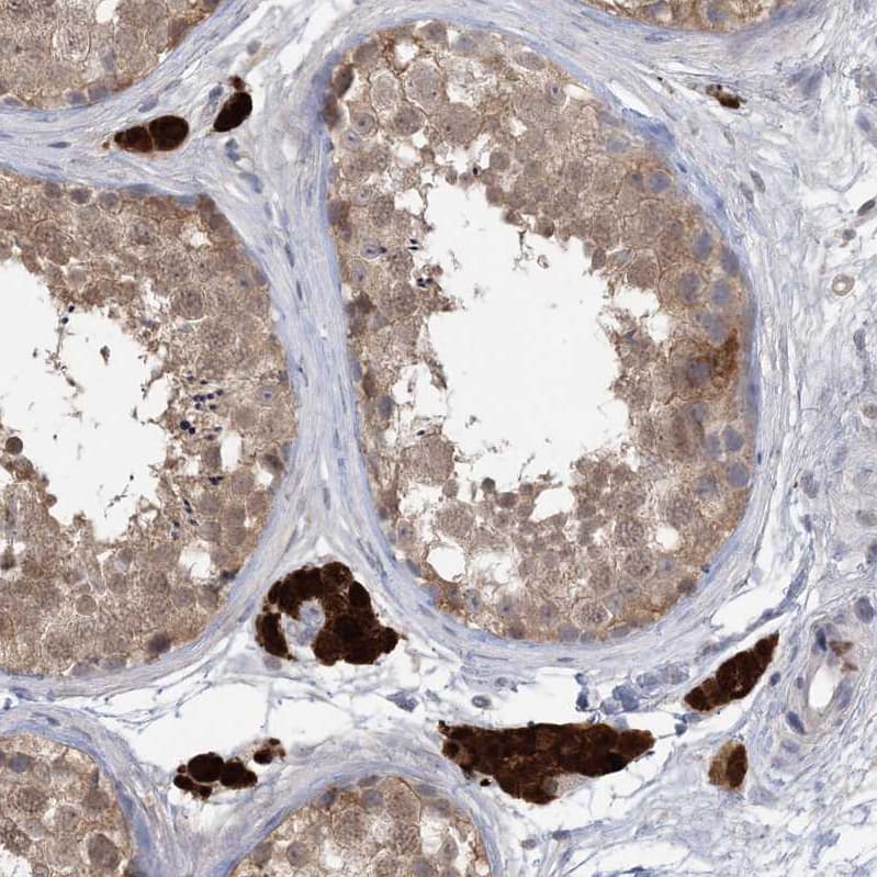 Staining of human testis shows strong cytoplasmic positivity in Leydig cells.