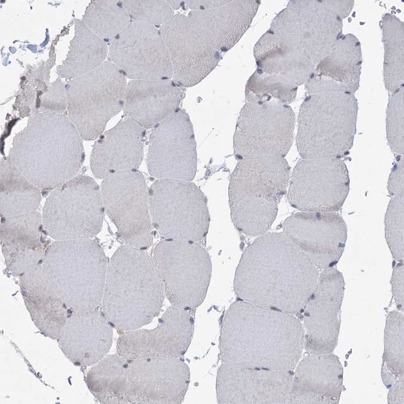 Staining of human skeletal muscle shows no positivity in myocytes as expected.