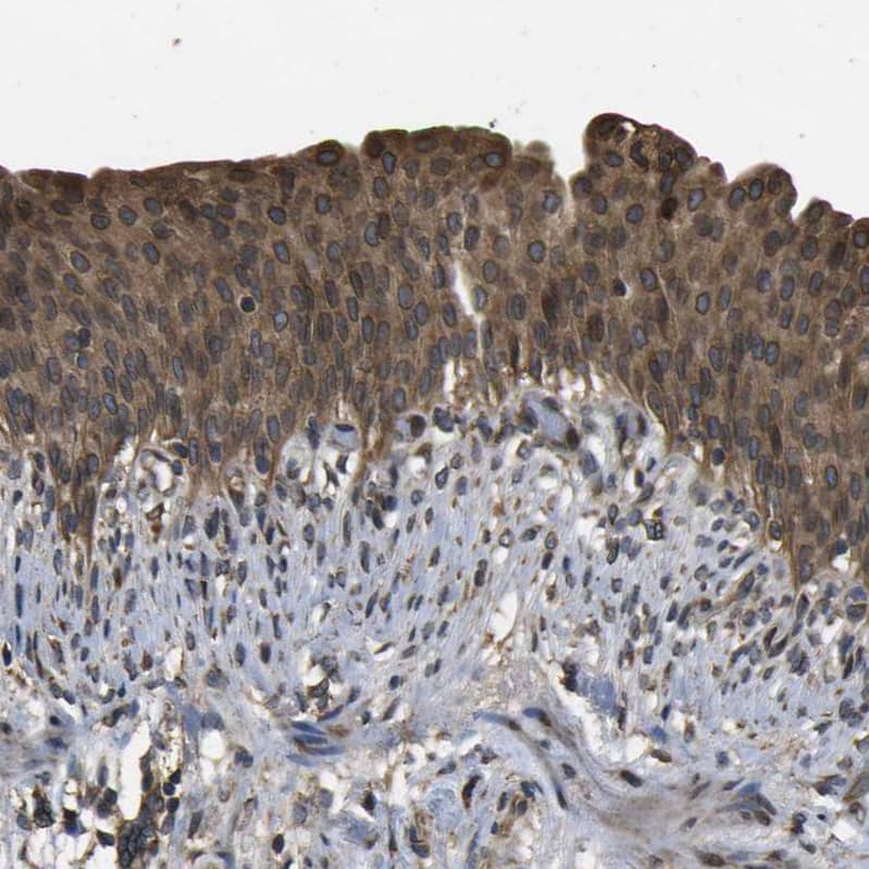Staining of human urinary bladder shows strong cytoplasmic positivity in urothelial cells.