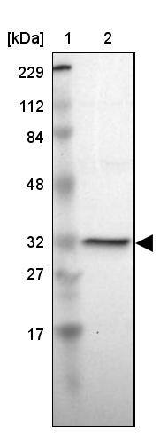 Lane 1: Marker [kDa] 229, 112, 84, 48, 32, 27, 17Lane 2: Human cell line RT-4