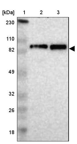 Lane 1: Marker [kDa] 230, 110, 82, 49, 32, 26, 18Lane 2: Human cell line RT-4Lane 3: Human cell line U-251MG sp