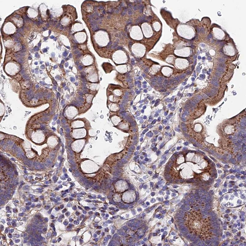 Immunohistochemistry-Paraffin GPR113 Antibody - BSA Free