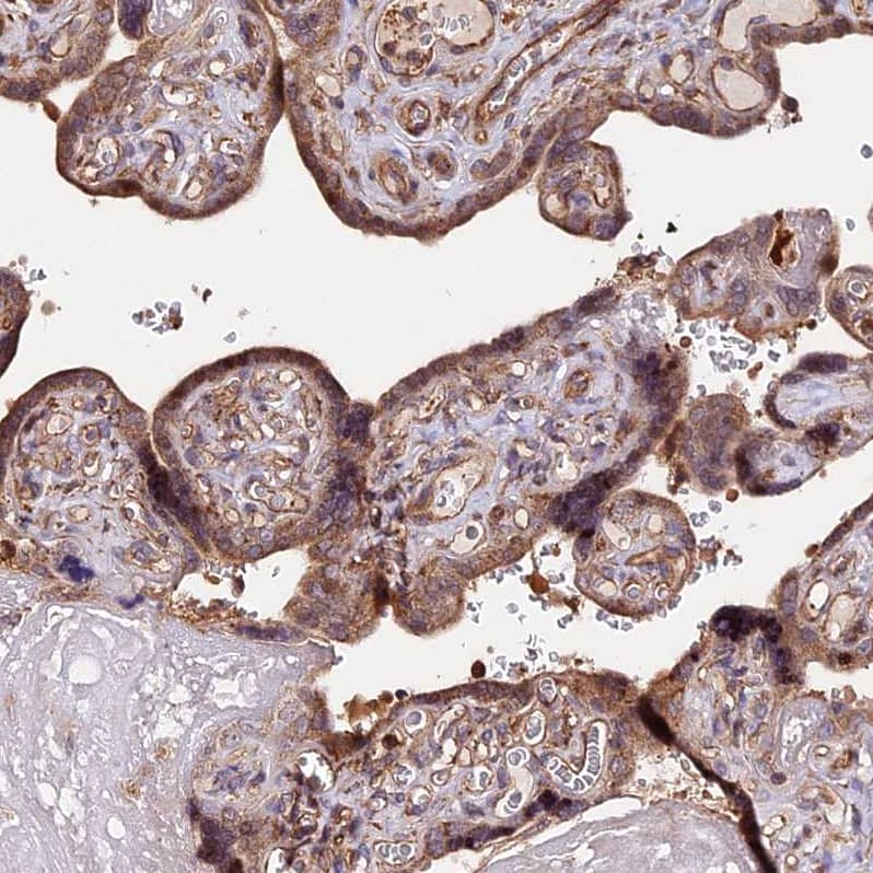 Staining of human placenta shows moderate cytoplasm granular positivity in trophoblastic cells.