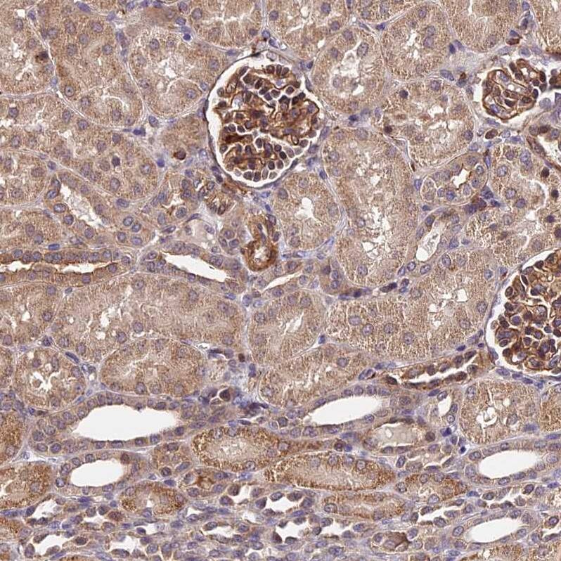 Staining of human kidney shows strong cytoplasm granular positivity in cells in glomeruli.