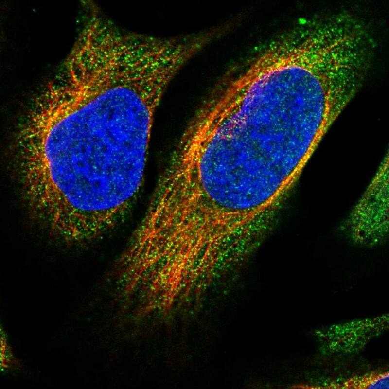 Staining of human cell line U-2 OS shows localization to cytosol.