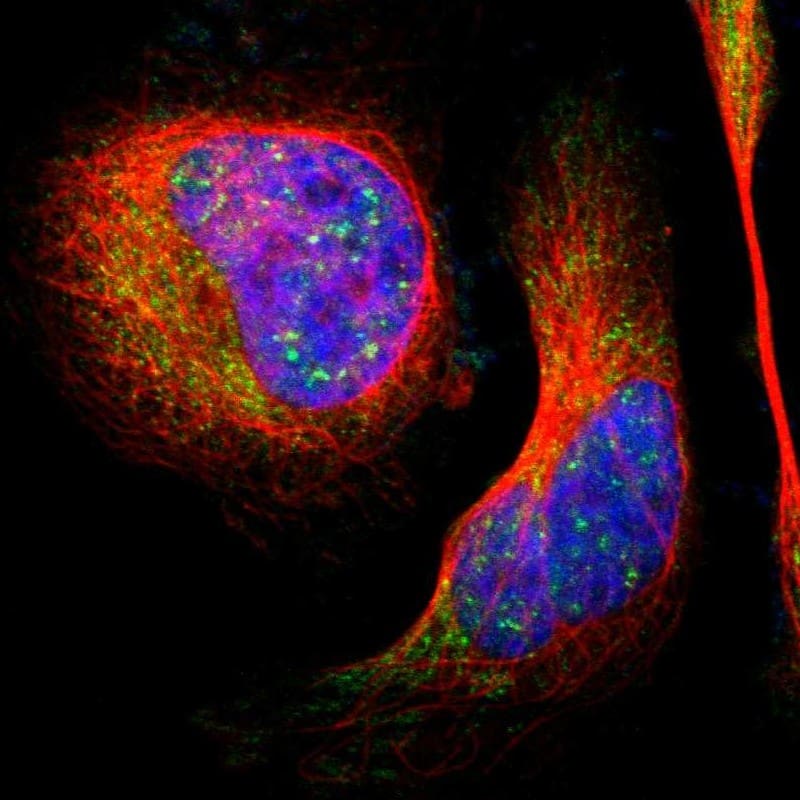 Immunocytochemistry/ Immunofluorescence LHPP Antibody - BSA Free
