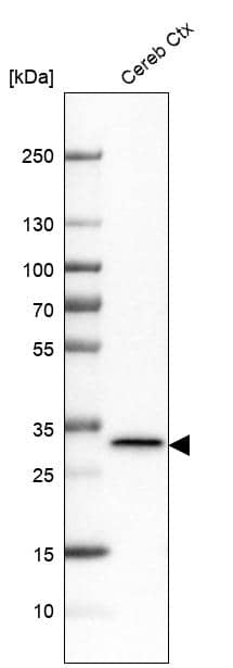 Analysis in human cerebral cortex tissue.