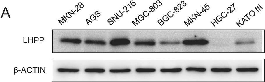 LHPP inhibits GC proliferation and metastasis in vitro.A Basic protein expression of LHPP in GC cell lines (MKN-28, AGS, SNU-216, MGC-803, BGC, MKN-45, HGC-27 and KATO III) was detected by western blotting. B HGC-27 cells with stable LHPP overexpression or MGC-803 cells with LHPP knockdown were created. The changes in LHPP expression were confirmed using western blotting. C, D The proliferative ability of stably transfected HGC-27 or MGC-803 cells was investigated via CCK-8 assays and colony formation. CCK-8 data were analyzed using a two-way analysis of variance. Colony number data were analyzed using the Wilcoxon test. Scale bars = 1 cm. E The drug resistance of stably transfected HGC-27 or MGC-803 cells was investigated via IC50 assays and colony formation. F Transwell assays with stably transfected HGC-27 and MGC-803 cells were performed. Representative images and quantification of the results are presented. Scale bars = 100 μm. Cell number data were analyzed using the Wilcoxon test. ***P < 0.001, GC gastric cancer, OXA Oxaliplatin. Image collected and cropped by CiteAb from the following open publication (//pubmed.ncbi.nlm.nih.gov/35568711), licensed under a CC-BY license. Not internally tested by Novus Biologicals.