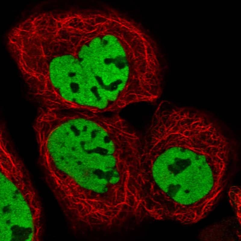 Staining of human cell line A-431 shows localization to nucleoplasm.