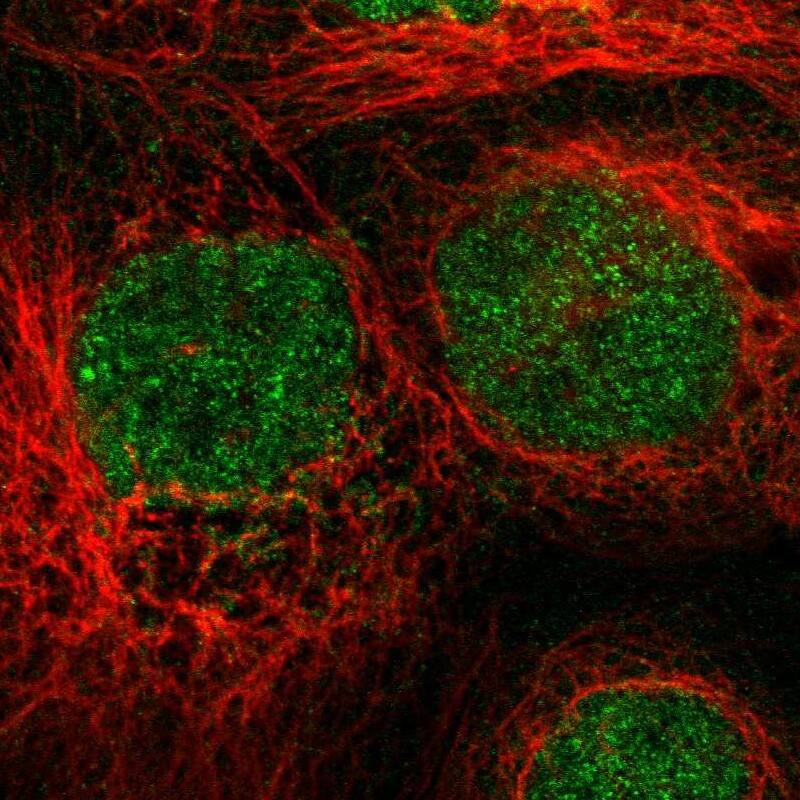 Staining of human cell line A-431 shows localization to nucleus.