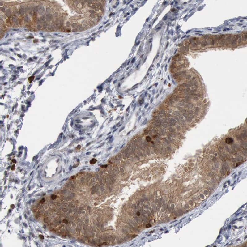 Staining of human fallopian tube shows moderate cytoplasmic positivity in glandular cells.