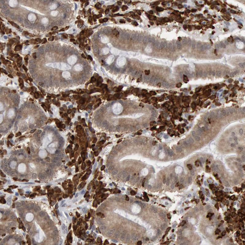 Staining of human duodenum shows strong cytoplasmic positivity in lymphoid cells.