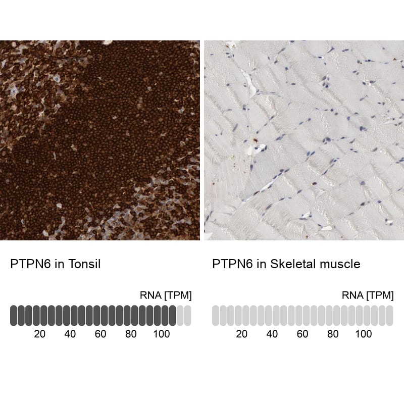 <b>Orthogonal Strategies Validation. </b>Analysis in human tonsil and skeletal muscle tissues using NBP1-83276 antibody. Corresponding PTPN6 RNA-seq data are presented for the same tissues.