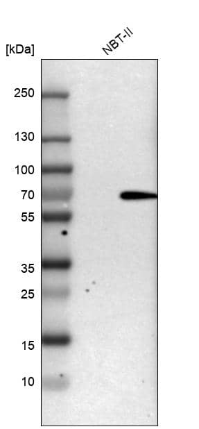 Analysis in rat cell line NBT-II.