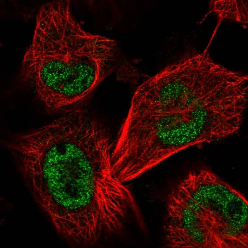 Immunocytochemistry/ Immunofluorescence SAP30BP Antibody - BSA Free