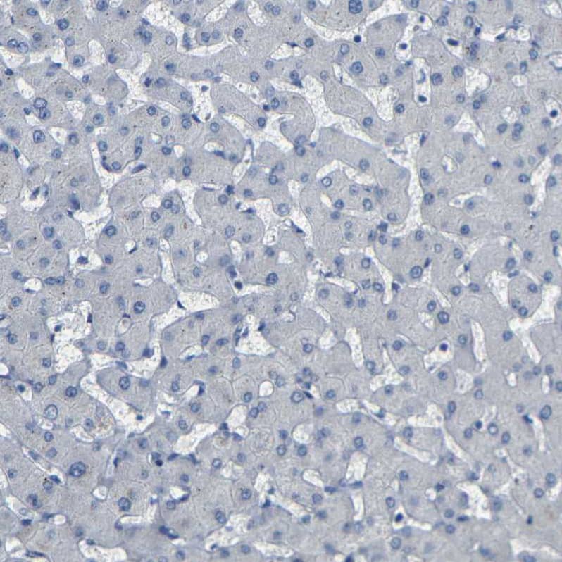 Immunohistochemistry-Paraffin NMES1 Antibody