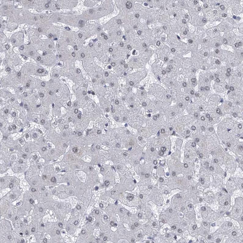 Immunohistochemistry-Paraffin Centrin 2 Antibody