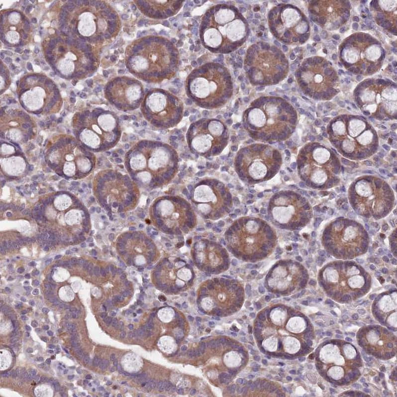 Immunohistochemistry-Paraffin TYW1 Antibody
