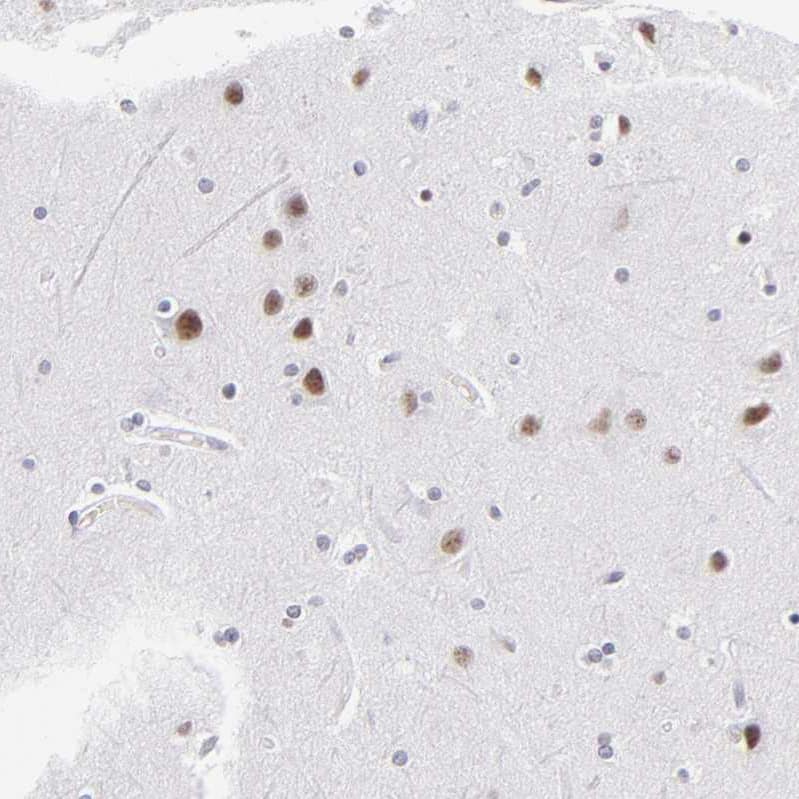 Immunohistochemistry-Paraffin SNRPN Antibody