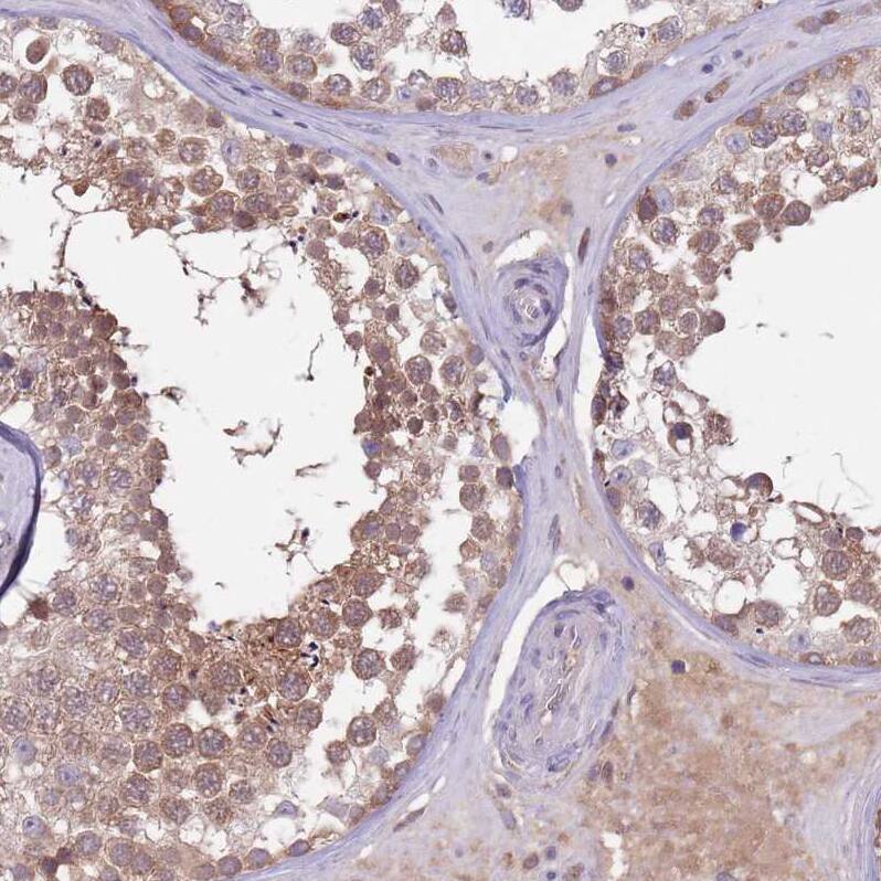 Immunohistochemistry-Paraffin TYW1 Antibody
