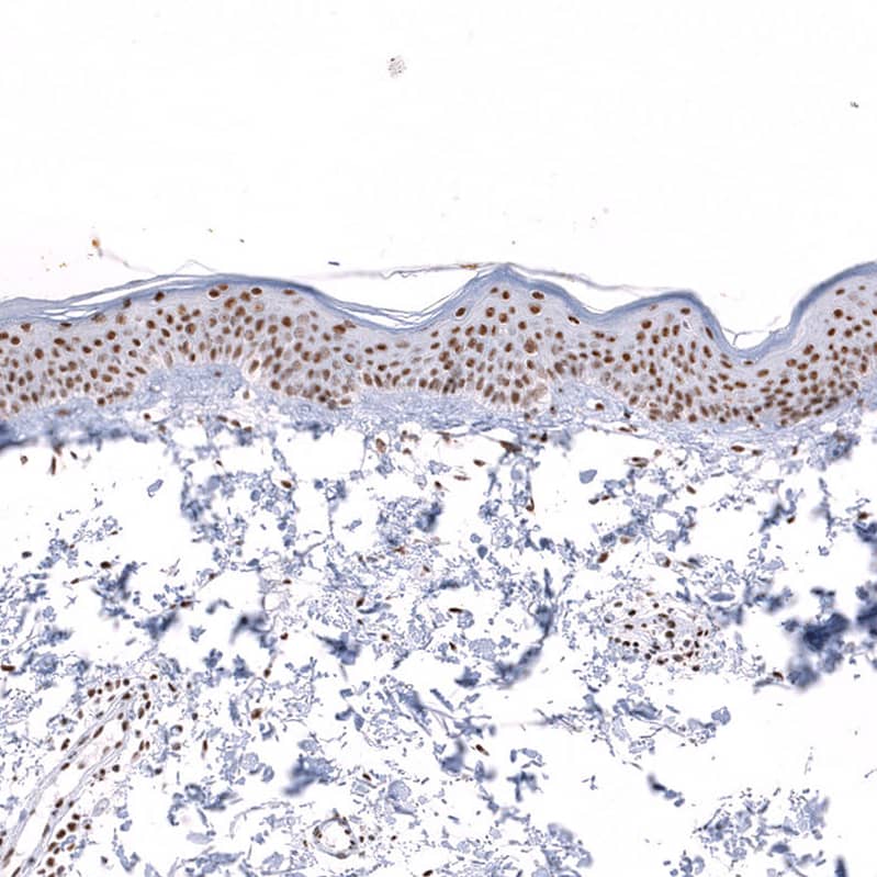 Immunohistochemistry-Paraffin SNRPN Antibody