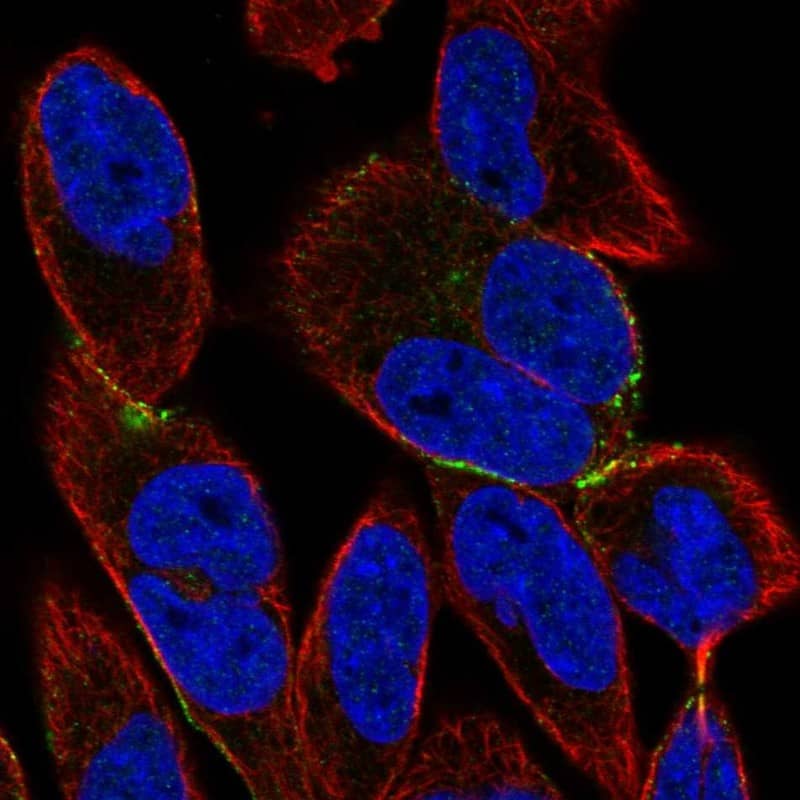 Staining of human cell line RH-30 shows localization to cell junctions.