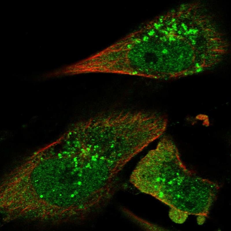 Staining of human cell line U-251 MG shows localization to nucleoplasm, cytosol & vesicles.