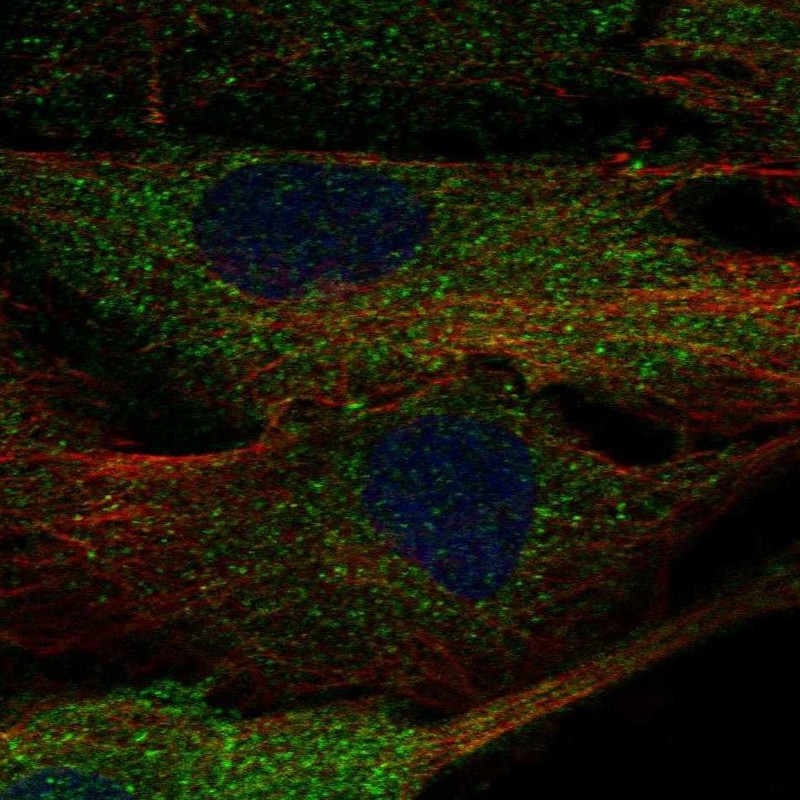 Immunocytochemistry/ Immunofluorescence ALPK2 Antibody - BSA Free