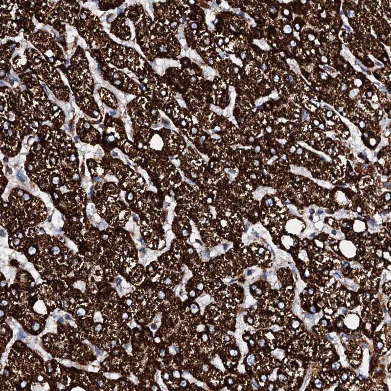 Staining of human liver shows strong granular cytoplasmic positivity in hepatocytes.