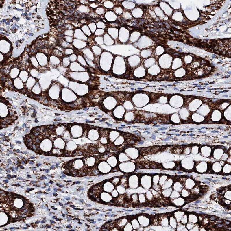 Staining of human rectum shows strong granular cytoplasmic positivity in glandular cells.