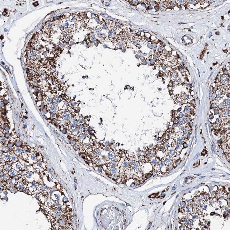 Staining of human testis shows moderate granular cytoplasmic positivity in cells in seminiferous ducts.