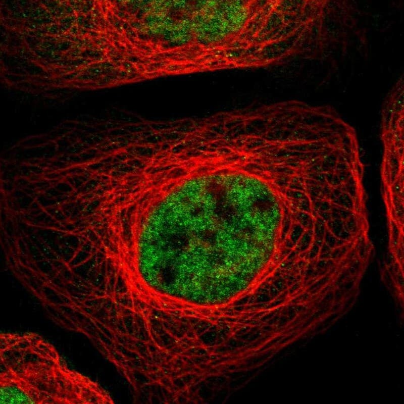 Staining of human cell line A-431 shows localization to nucleoplasm.