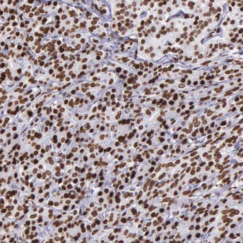 Staining of human pancreas shows strong nuclear positivity in exocrine glandular cells.