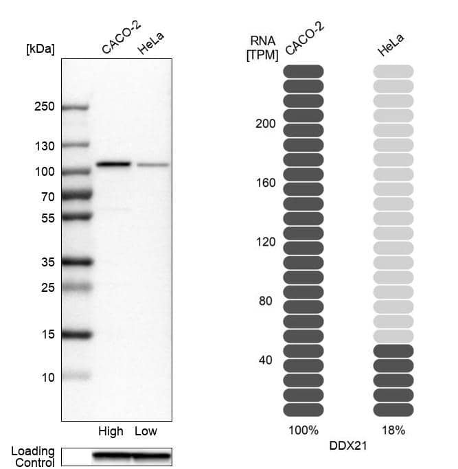 Analysis in human cell lines Caco-2 and HeLa using Anti-DDX21 antibody. Corresponding DDX21 RNA-seq data are presented for the same cell lines. Loading control: Anti-GAPDH.